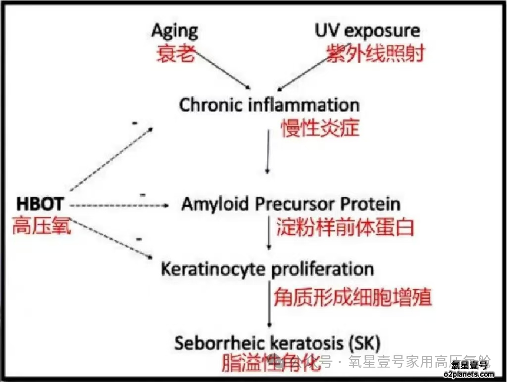 氧星壹号家用高压氧舱:连泰国选美冠军都pick的”状态管理“神器!