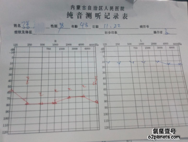 【科普】 | 话说“突聋”，有一种治疗措施叫“高压氧”