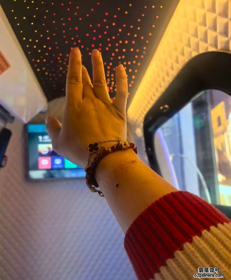 氧星壹号家用高压氧舱氧疗实例