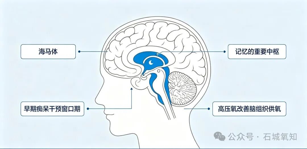 高压氧，为早期老年痴呆按下“减速刹车”